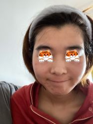 -agge蛋白医美