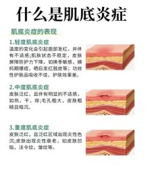 点击看大图 -MLP美丽派·问题肌疗愈中心