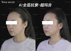 -Yestar重庆艺星医疗美容医院