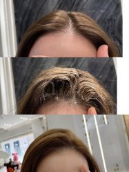 -MI HAIR