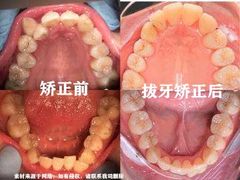 -团圆口腔·种植中心(锦江院区)