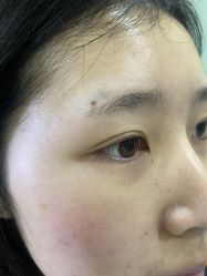 体验前-重庆联合丽格第五医疗美容医院
