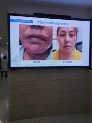 -成都军建医院·疤痕诊疗中心