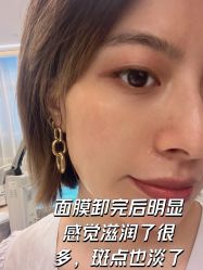 体验后-杭州米兰柏羽医疗美容医院