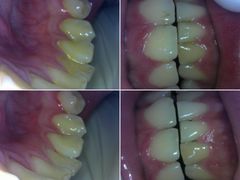 -同步齿科·数字化正畸种植口腔中心(珠海店)