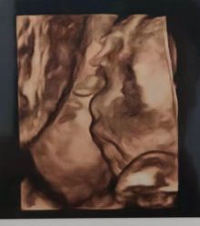 -杭州贝瑞斯美华妇儿医院·早孕·产检·儿科