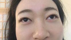 -宥莉·ULLY 痘敏肌•科技皮肤管理中心
