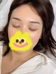 点击看大图 -Doris多里斯半永久纹眉·SMP纹发·发际线