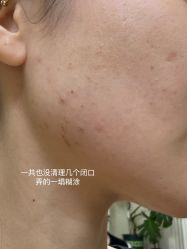 体验后-演员的秘密·皮肤管理