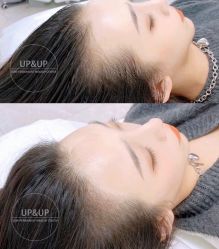 -UP&UP·半永久眉毛眼线机器野生眉