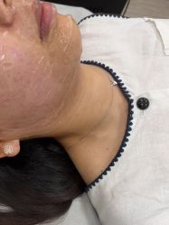点击看大图 -Yestar艺星整形美容医院