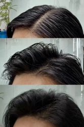 -GANO HAIR 