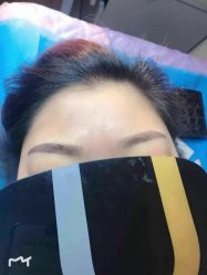 点击看大图 体验后-坤如玛丽·医疗美容中心