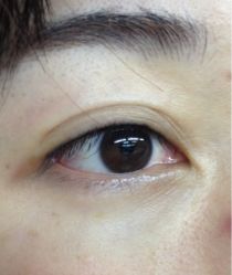 半永久隐形眼线-平萍纹绣韩式半永久定妆