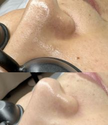 -SKIN79皮肤管理中心