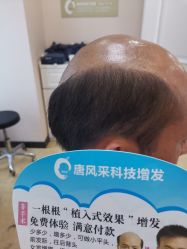 -唐风采假发补发定制