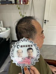 -唐风采假发补发定制