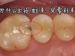 -团圆口腔·种植中心(锦江院区)