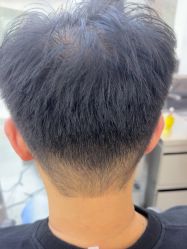-天使之手