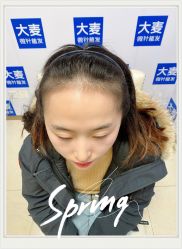 -大麦微针植发全国连锁