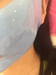 -成都苗方清颜专业祛痘