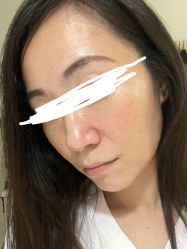 体验后-上海首尔丽格医疗美容医院