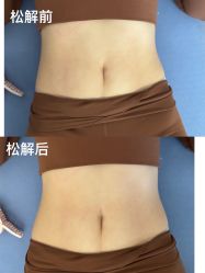 -玖也普拉提
