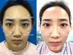 -南京健丽·去眼袋医疗美容机构