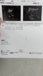 -北京妇产医院(东院)