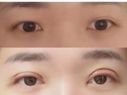 -郡艺医疗美容·微整·眼鼻吸脂