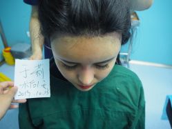 -大麦微针植发丨全国连锁