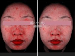 点击看大图 -Hi Beauty Skin 科技美肤中心