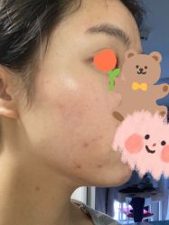 体验前-深圳广和门诊部·整形医疗美容
