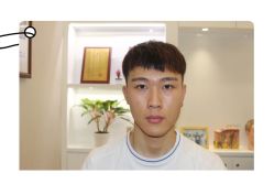 -大麦微针植发全国连锁