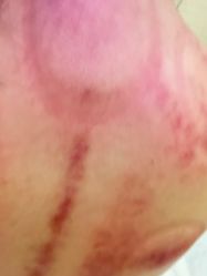 -芳朵美容养生SPA