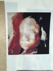 -郑州万安妇产医院