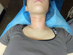 -上海玫瑰医疗美容医院