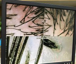 -章光101养发生发防脱发