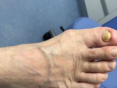 -Andrew指甲专科灰指甲·甲沟炎矫正·3D步态矫形鞋垫定制(上海法华镇路旗舰店)