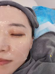 体验后-More摩尔医美の注射线雕光电中心