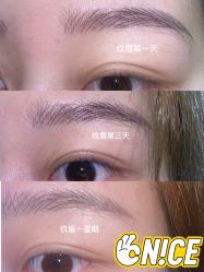 -OnFaer.纹眉半永久无创洗眉