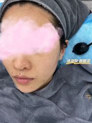 体验前-澳尔颜选医疗美容