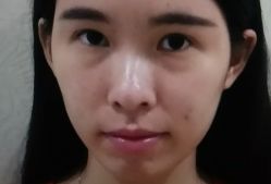 -弘美医美·艾维岚童颜抗衰中心