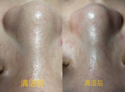 -SKIN MOLY魔力之肌皮肤管理中心