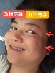 -上海玫瑰医疗美容医院