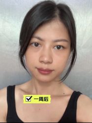 -广东韩妃整形外科医院