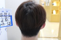 点击看大图 -大麦微针植发丨全国连锁