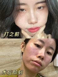 -海峡医疗美容医院