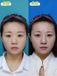 -深圳艺星医疗美容医院