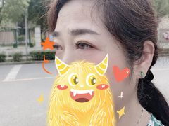 体验后-上海华安整形外科门诊部